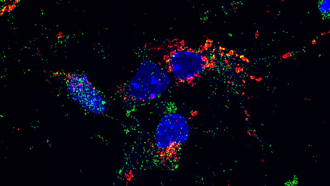 Fotos de células vistas al microscopio
