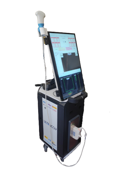 Ultracov: ecografía pulmonar con Inteligencia Artificial